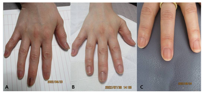 Clinical Research in Dermatology