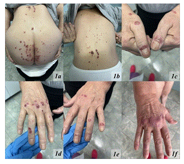 Clinical Research in Dermatology