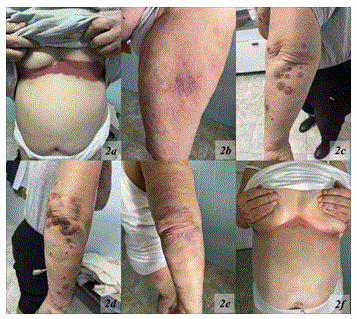 Clinical Research in Dermatology