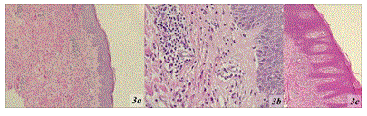 Clinical Research in Dermatology