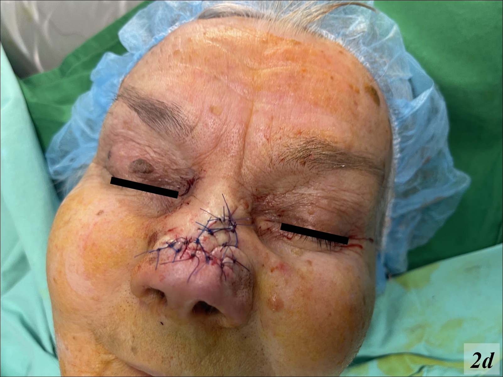 Clinical Research in Dermatology