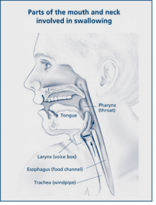 Dysphagia Mechanical Soft Diet Guidelines Ada